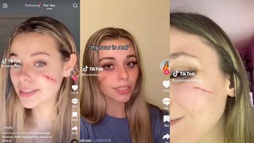 Gesichtsnarben sind lustig und cool – suggeriert der neueste Tiktok-Unfug.