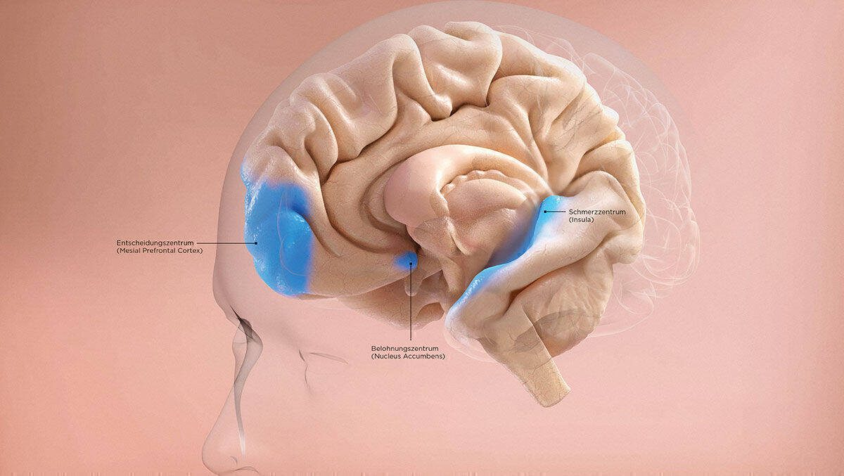 Von Belohnung bis Schmerz: Verschiedene Areale im Gehirn beeinflussen die Kaufentscheidung